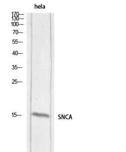 Western blot analysis of hela lysis using Anti-SNCA Antibody