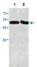 Anti-ACTL7A Rabbit Polyclonal Antibody