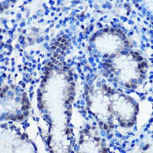 Immunohistochemistry analysis of paraffin-embedded human stomach using Anti-Brd4 Antibody (A308054) at a dilution of 1:100 (40X lens). Perform microwave antigen retrieval with 10 mM PBS buffer pH 7.2 before commencing with IHC staining protocol