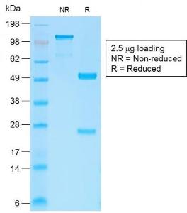 Anti-beta Catenin antibody