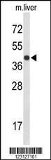 Anti-CENPK Rabbit Polyclonal Antibody (AP (Alkaline Phosphatase))