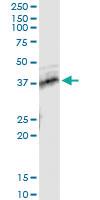 Anti-TNFRSF10B Antibody Pair