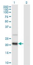 Anti-RAX2 Mouse Polyclonal Antibody