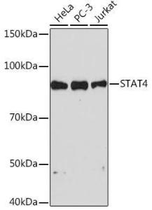 Western blot analysis of extracts of various cell lines, using Anti-STAT4 Antibody [ARC1071] (A306876) at 1:1,000 dilution. The secondary antibody was Goat Anti-Rabbit IgG H&L Antibody (HRP) at 1:10,000 dilution.