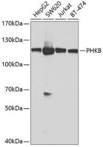 Western blot analysis of extracts of various cell lines, using Anti-Phosphorylase B/PHKB Antibody (A12198) at 1:1,000 dilution The secondary antibody was Goat Anti-Rabbit IgG H&L Antibody (HRP) at 1:10,000 dilution Lysates/proteins were present at 25 µg per lane