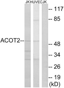 Western blot analysis of lysates from Jurkat and HUVEC cells using Anti-ACOT2 Antibody. The right hand lane represents a negative control, where the antibody is blocked by the immunising peptide