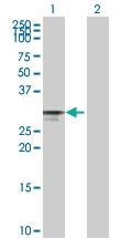 Anti-CDK4 Rabbit Polyclonal Antibody