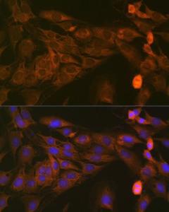 Immunofluorescence analysis of C6 cells using Anti-STAT4 Antibody [ARC1071] (A306876) at a dilution of 1:100 (40x lens). DAPI was used to stain the cell nuclei (blue).