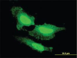 Anti-FGF1 Mouse Monoclonal Antibody [clone: 2E12]