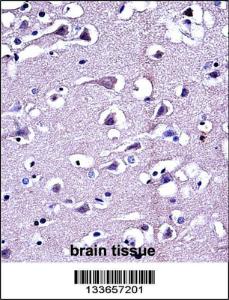 Anti-MMP16 Rabbit Polyclonal Antibody (FITC (Fluorescein Isothiocyanate))