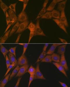 Immunofluorescence analysis of NIH-3T3 cells using Anti-STAT4 Antibody [ARC1071] (A306876) at a dilution of 1:100 (40x lens). DAPI was used to stain the cell nuclei (blue).