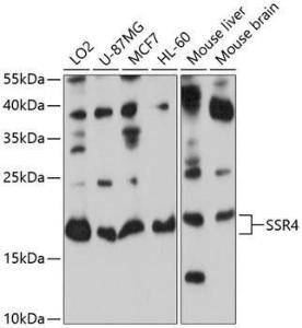 Anti-SSR4 Rabbit Polyclonal Antibody