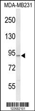 Anti-PIK3CG Rabbit Polyclonal Antibody