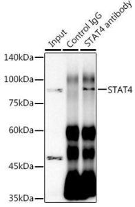 Immunoprecipitation analysis of 300µg extracts of HeLa cells using 3µg of Anti-STAT4 Antibody [ARC1071] (A306876). This Western blot was performed on the immunoprecipitate using Anti-STAT4 Antibody [ARC1071] (A306876) at a dilution of 1:1000.