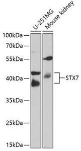 Anti-Syntaxin 7 Rabbit Polyclonal Antibody