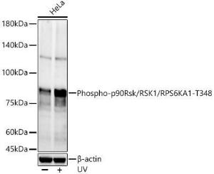 Western blot analysis of HeLa, using Anti-RSK1 p90 (phospho Thr348) Antibody (A309559) at 1:600 dilution