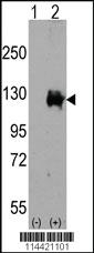 Anti-TRPM8 Rabbit Polyclonal Antibody