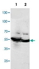 Anti-DLD Rabbit Polyclonal Antibody