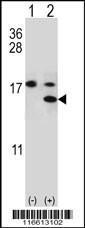 Anti-S100A11 Rabbit Polyclonal Antibody (APC (Allophycocyanin))