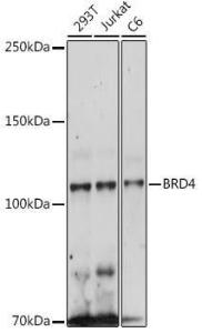 Western blot analysis of extracts of various cell lines, using Anti-Brd4 Antibody (A308055) at 1:500 dilution The secondary antibody was Goat Anti-Rabbit IgG H&L Antibody (HRP) at 1:10,000 dilution Lysates/proteins were present at 25 µg per lane