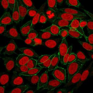 Anti-beta Catenin antibody