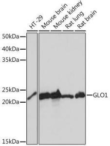 Western blot analysis of extracts of various cell lines, using Anti-GLO1 Antibody [ARC0969] (A306878) at 1:1,000 dilution. The secondary antibody was Goat Anti-Rabbit IgG H&L Antibody (HRP) at 1:10,000 dilution.