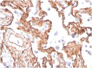 Immunohistochemical analysis of formalin-fixed, paraffin-embedded human lung tissue using Anti-alpha II Spectrin Antibody [SPTAN1/3505]