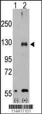 Anti-TRPM8 Rabbit Polyclonal Antibody