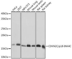 Western blot analysis of extracts of various cell lines, using Anti-p18 INK4c / CDKN2C Antibody [ARC1289] (A306879) at 1:1000 dilution