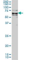 Anti-KLF11 Mouse Monoclonal Antibody [clone: 8F4]