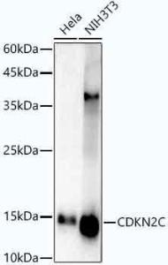 Western blot analysis of extracts of HepG2 cells, using Anti-p18 INK4c / CDKN2C Antibody [ARC1289] (A306879) at 1:1000 dilution