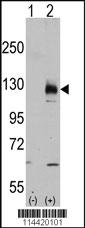 Anti-TRPM8 Rabbit Polyclonal Antibody