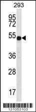 Anti-ATP6V1B1 Rabbit Polyclonal Antibody (PE (Phycoerythrin))