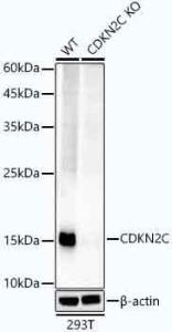 Western blot analysis of extracts from wild type(WT) and CDKN2C knockout (KO) 293T cells, using Anti-p18 INK4c / CDKN2C Antibody [ARC1289] (A306879) at 1:1000 dilution