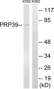 Western blot analysis of lysates from K562 cells using Anti-PRPF39 Antibody. The right hand lane represents a negative control, where the antibody is blocked by the immunising peptide.