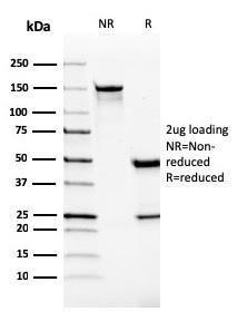 SDS-PAGE analysis of Anti-VISTA Antibody [VISTA/2865] under non-reduced and reduced conditions; showing intact IgG and intact heavy and light chains, respectively. SDS-PAGE analysis confirms the integrity and purity of the Antibody