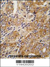 Anti-TRPM8 Rabbit Polyclonal Antibody