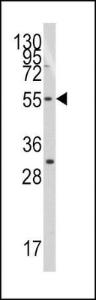 Anti-TERF1 Rabbit Polyclonal Antibody