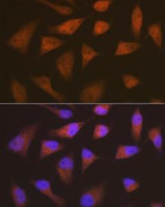 Immunofluorescence analysis of HeLa cells using Anti-p18 INK4c / CDKN2C Antibody [ARC1289] (A306879) at a dilution of 1:100 (40x lens). DAPI was used to stain the cell nuclei (blue)