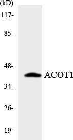 Western blot analysis of the lysates from HT 29 cells using Anti-ACOT1 Antibody