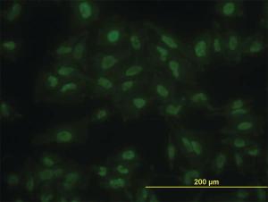 Anti-KLF11 Mouse Monoclonal Antibody [clone: 8F4]