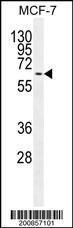 Anti-MAP Kinase 15 Mouse Monoclonal Antibody (AP (Alkaline Phosphatase)) [clone: 168CT10.6.6]