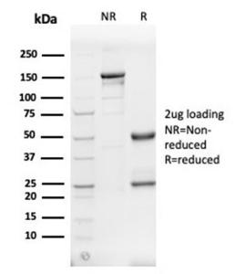 SDS-PAGE analysis of Anti-alpha II Spectrin Antibody [SPTAN1/3505] under non-reduced and reduced conditions; showing intact IgG and intact heavy and light chains, respectively. SDS-PAGE analysis confirms the integrity and purity of the antibody