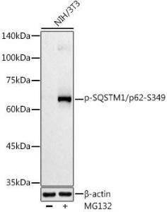 Western blot analysis of extracts of NIH/3T3 cells, using Anti-SQSTM1 / p62 (phospho Ser349) Antibody (A305624) at 1:500 dilution