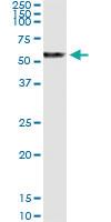 Anti-PRAME Polyclonal Antibody Pair