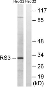 Anti-RPS3 antibody