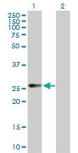 Anti-CDK20 Mouse Polyclonal Antibody