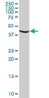 Anti-CDK20 Mouse Polyclonal Antibody