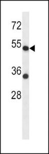 Anti-ADRA2C Rabbit Polyclonal Antibody (FITC (Fluorescein Isothiocyanate))