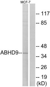 Antibody anti-ABHD9 100 µg